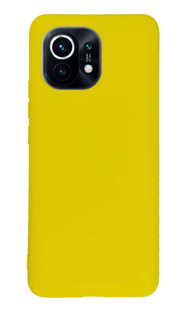 Xiaomi Mi 11 Kılıf Tasarla Lansman Dokulu Kapak