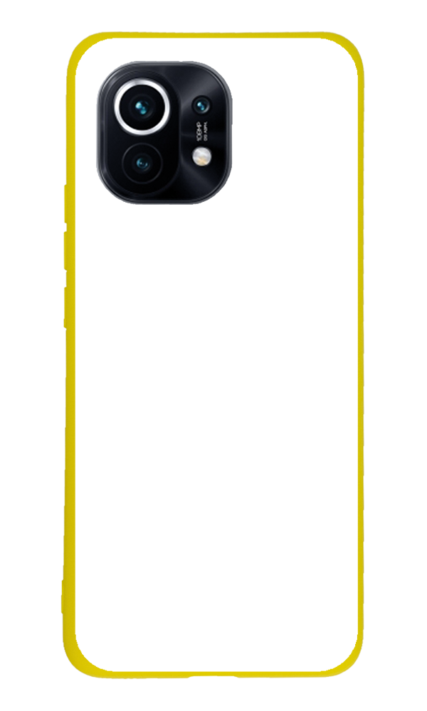 Xiaomi Mi 11 Lite Kılıf Tasarla Lansman Dokulu Kapak