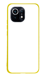 Xiaomi Mi 11 Lite Kılıf Tasarla Lansman Dokulu Kapak