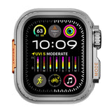 Apple Watch 44mm to Apple Watch Ultra 49mm Kasa Dönüştürücü Zore Watch Gard 33 Gri