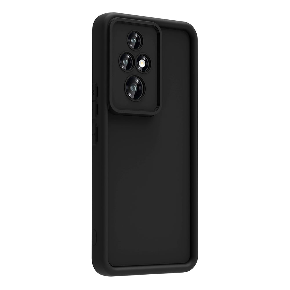 Honor 200 Pro Kılıf Kamera Korumalı Zore Ananas Kapak Koyu Yeşil