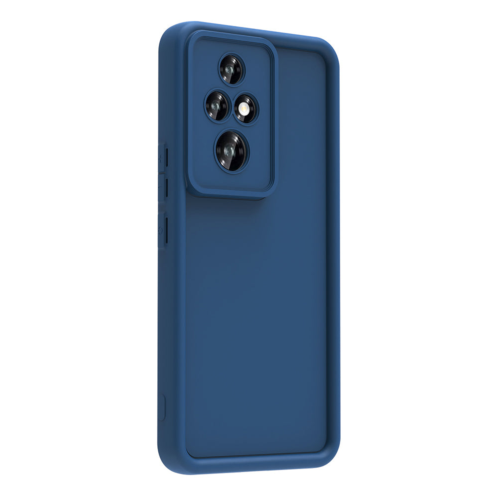 Honor 200 Pro Kılıf Kamera Korumalı Zore Ananas Kapak Pembe