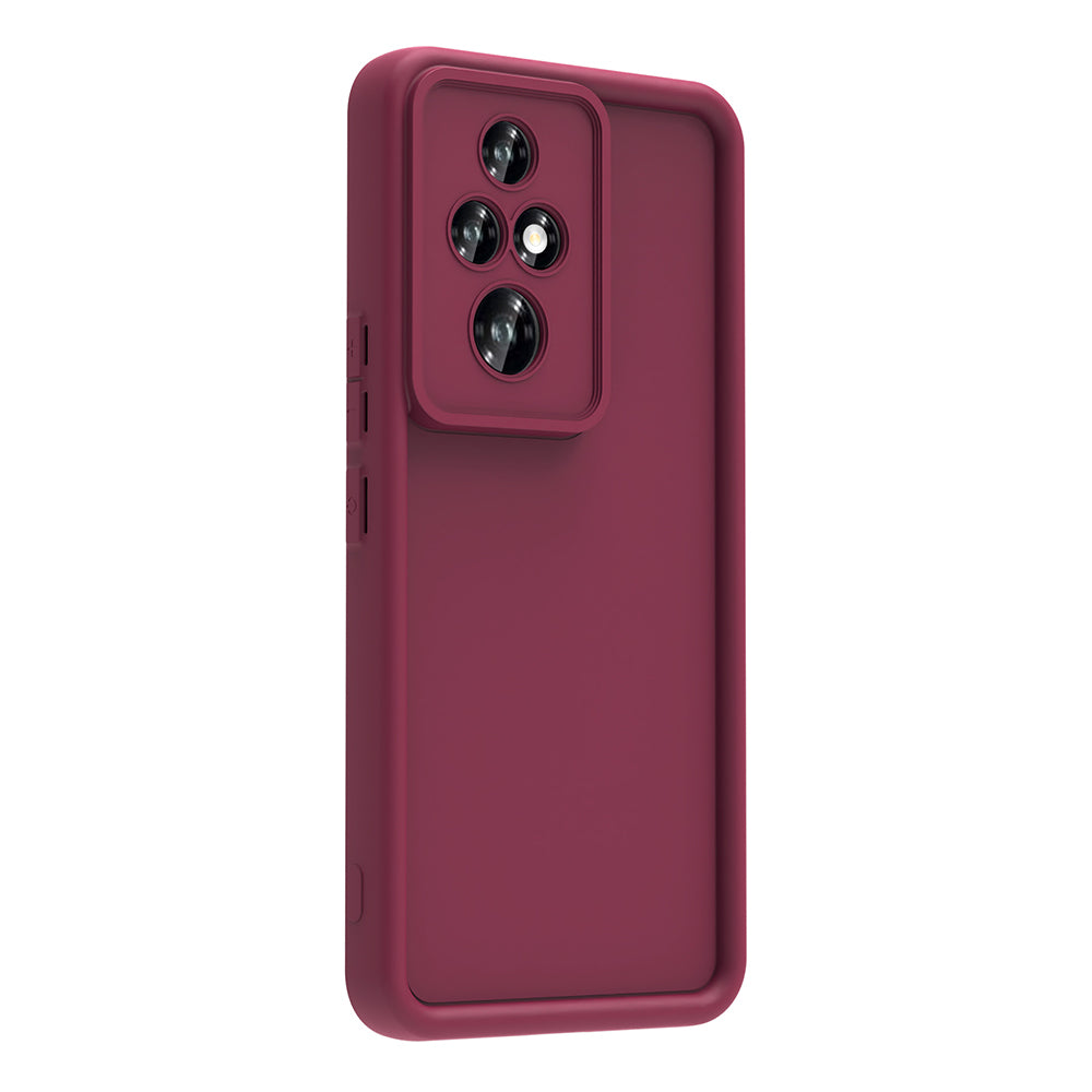Honor 200 Pro Kılıf Kamera Korumalı Zore Ananas Kapak Siyah