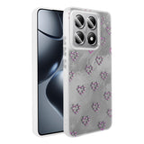 Xiaomi 14T Kılıf Kamera Korumalı Figürlü Zore Ponti Silikon Kapak Açık Pembe