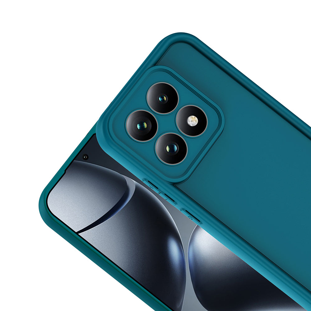 Xiaomi 15T Kılıf Kamera Korumalı Ananas Kapak Siyah