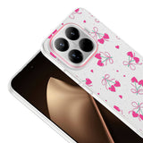 Xiaomi 15T Pro Kılıf Kamera Korumalı Desenli Zore Klip Kapak Kalpli Kiraz