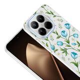 Xiaomi 15T Pro Kılıf Kamera Korumalı Desenli Zore Klip Kapak Mavi Lale
