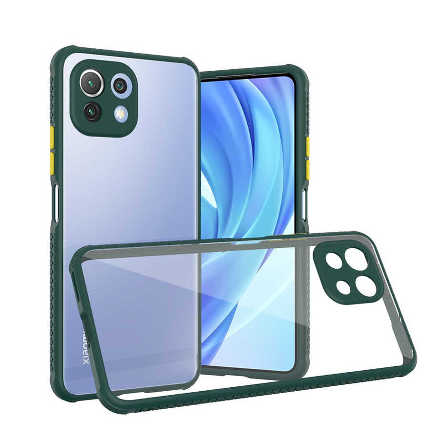 Xiaomi Mi 11 Lite Kılıf Zore Kaff Kapak Koyu Yeşil