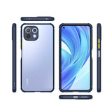 Xiaomi Mi 11 Lite Kılıf Zore Kaff Kapak Kırmızı
