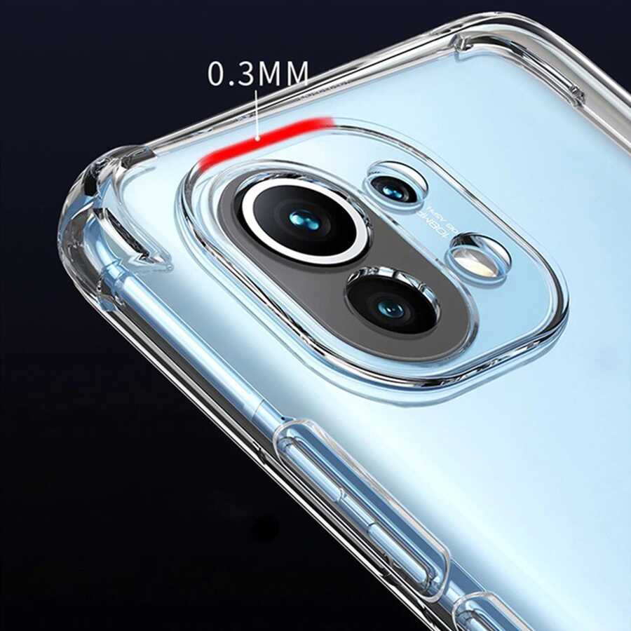 Xiaomi Mi 11 Lite Kılıf Zore Kamera Korumalı Nitro Anti Shock Silikon Renksiz