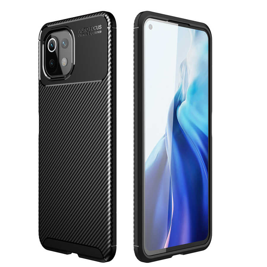 Xiaomi Mi 11 Lite Kılıf Zore Negro Silikon Kapak Siyah