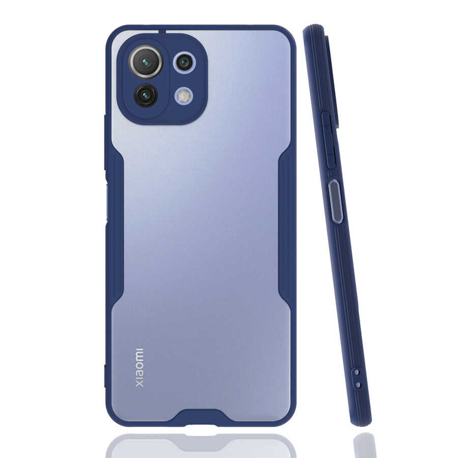 Xiaomi Mi 11 Lite Kılıf Zore Parfe Kapak Lacivert