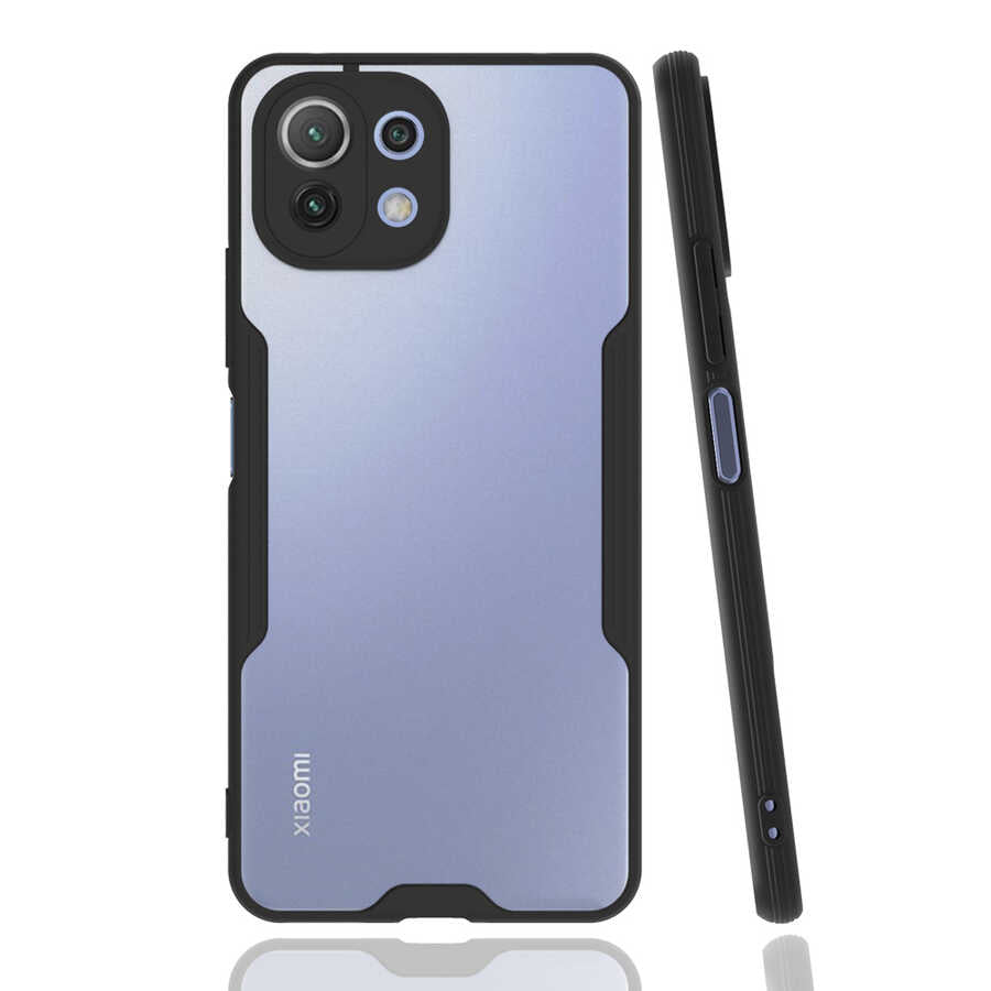 Xiaomi Mi 11 Lite Kılıf Zore Parfe Kapak Siyah