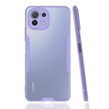 Xiaomi Mi 11 Lite Kılıf Zore Parfe Kapak Mor