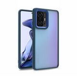 Xiaomi Mi 11T 5G Kılıf Zore Flora Kapak Mavi