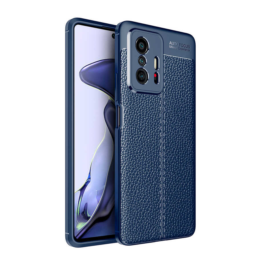 Xiaomi Mi 11T 5G Kılıf Zore Niss Silikon Kapak Siyah