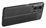 Xiaomi Mi 11T 5G Kılıf Zore Niss Silikon Kapak Siyah