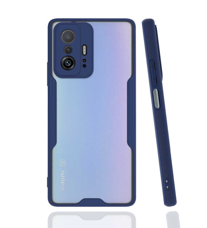 Xiaomi Mi 11T 5G Kılıf Zore Parfe Kapak Lacivert