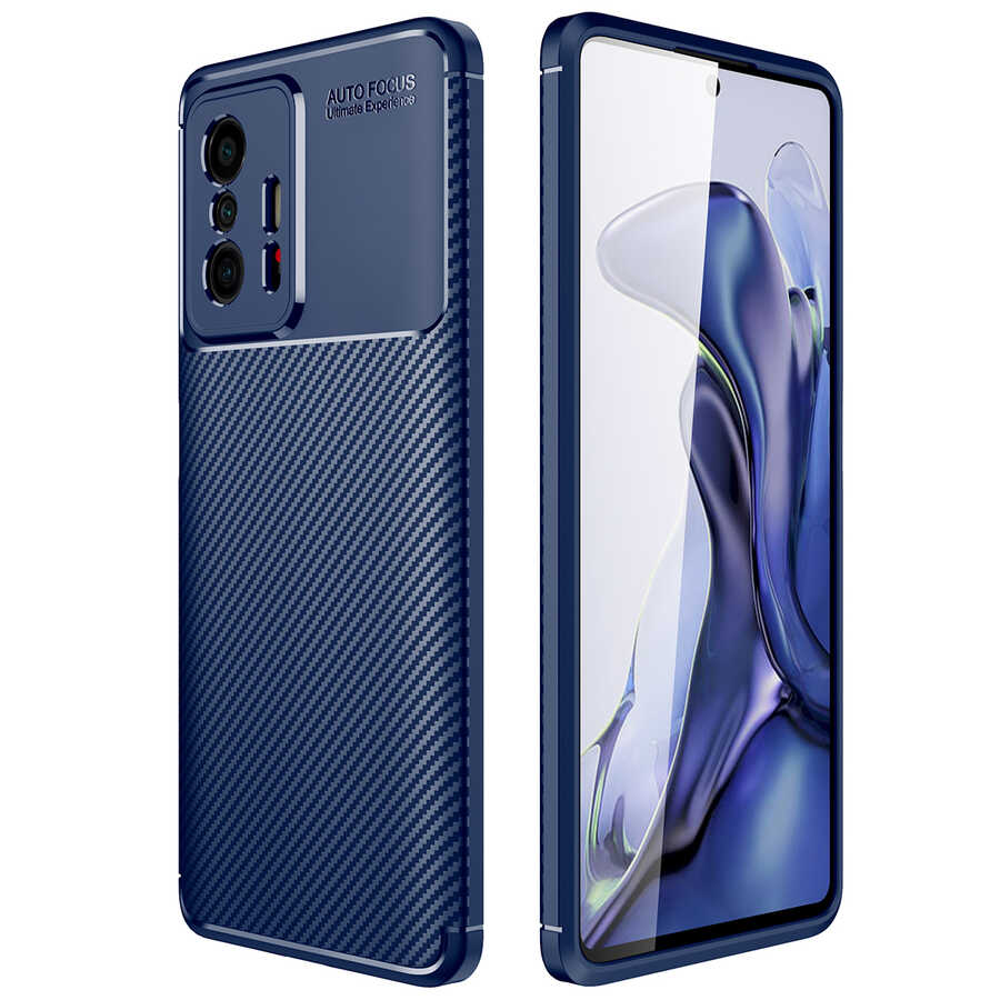Xiaomi Mi 11T Pro 5G Kılıf Zore Negro Silikon Kapak Siyah