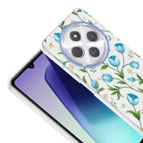 Xiaomi Redmi 14C 4G Kılıf Kamera Korumalı Desenli Zore Klip Kapak Mavi Lale