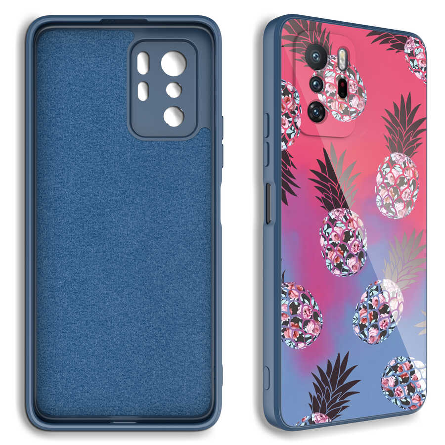 Xiaomi Redmi Note 10 Pro Kılıf Kamera Korumalı Desenli Sert Silikon Zore Epoksi Kapak NO2