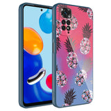 Xiaomi Redmi Note 11 Global Kılıf Kamera Korumalı Desenli Sert Silikon Zore Epoksi Kapak NO3