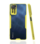 Xiaomi Redmi Note 11 Pro 5G Kılıf Zore Parfe Kapak Siyah