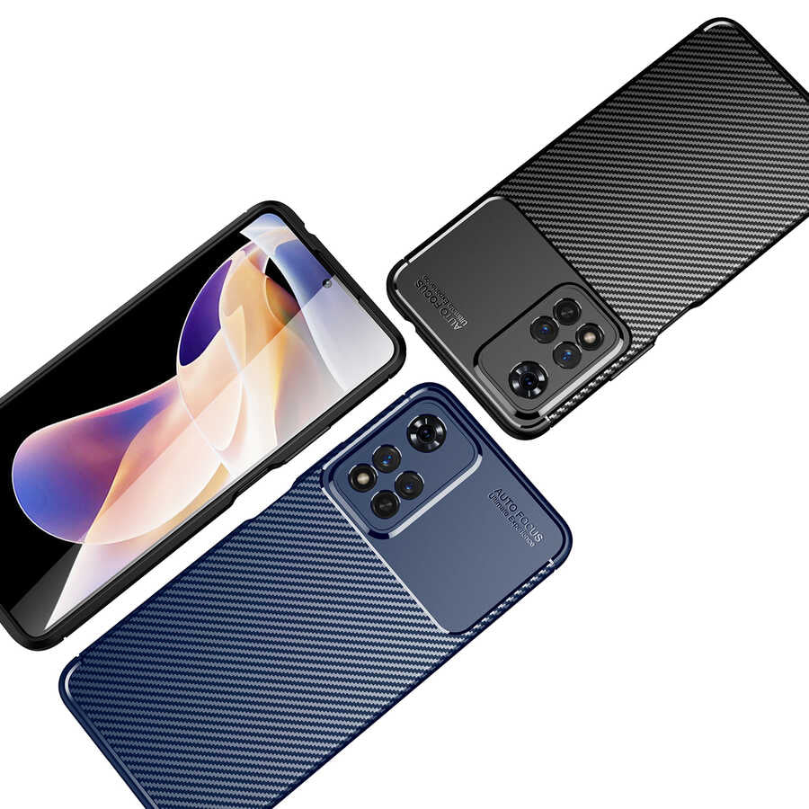 Xiaomi Redmi Note 11 Pro Plus 5G Kılıf Zore Negro Silikon Kapak Siyah