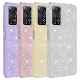 Xiaomi Redmi Note 12 Pro 4G Kılıf Zore Shining Silikon Mor