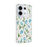 Xiaomi Redmi Note 13 Pro 5G Kılıf Kamera Korumalı Desenli Zore Klip Kapak Mavi Lale