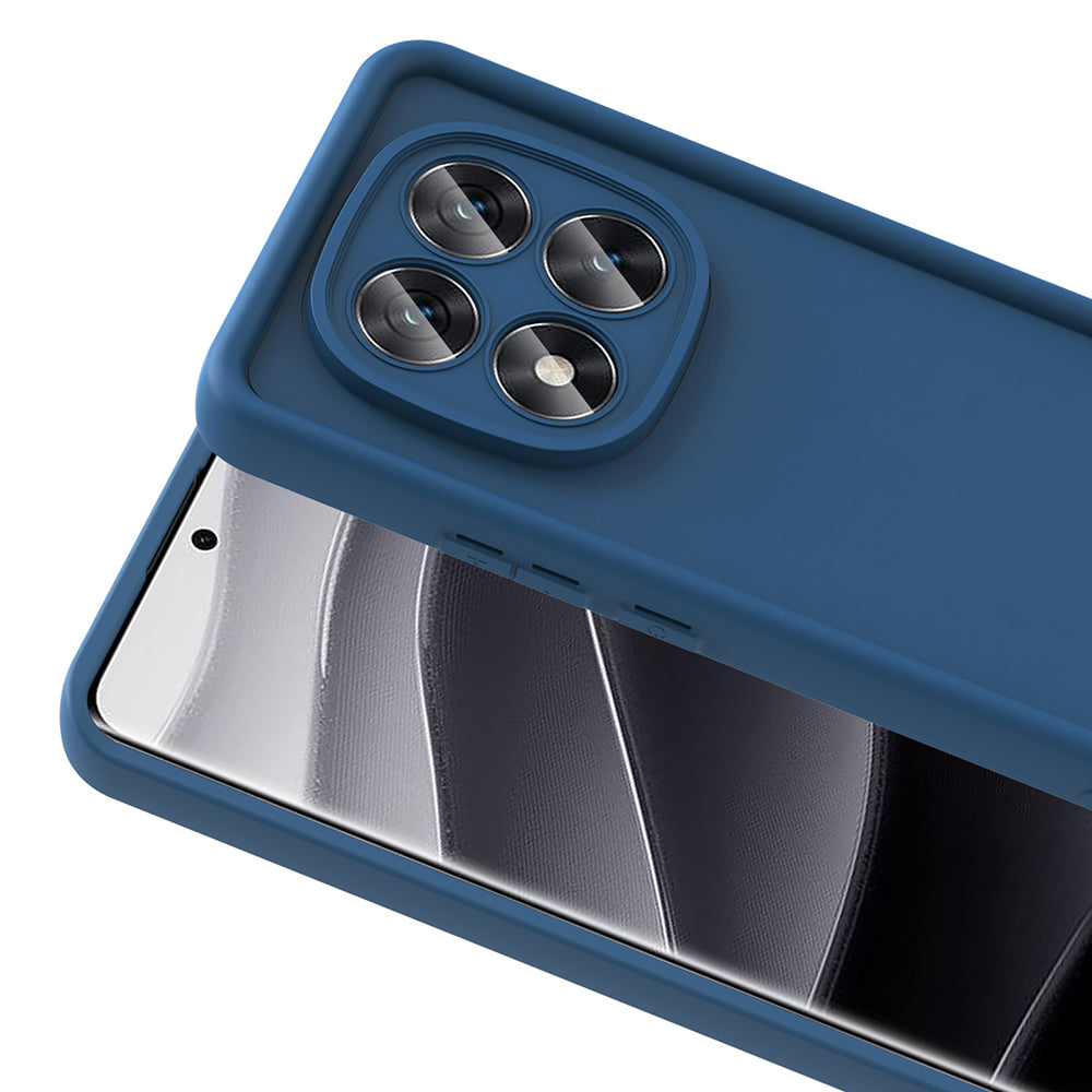 Xiaomi Redmi Note 14 Pro 5G Kılıf Kamera Korumalı Zore Ananas Kapak Pembe