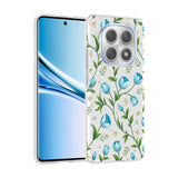 Xiaomi Redmi Note 15 4G Kılıf Kamera Korumalı Desenli Zore Klip Kapak Mavi Lale