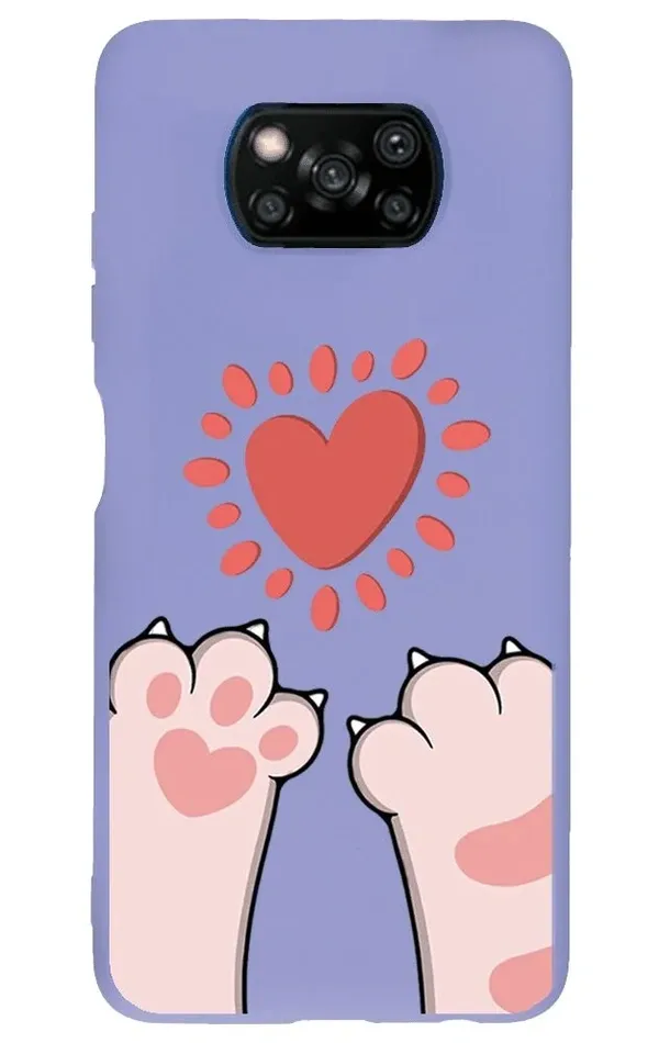 Xiaomi Poco X3 Lansman Kılıf - Pati